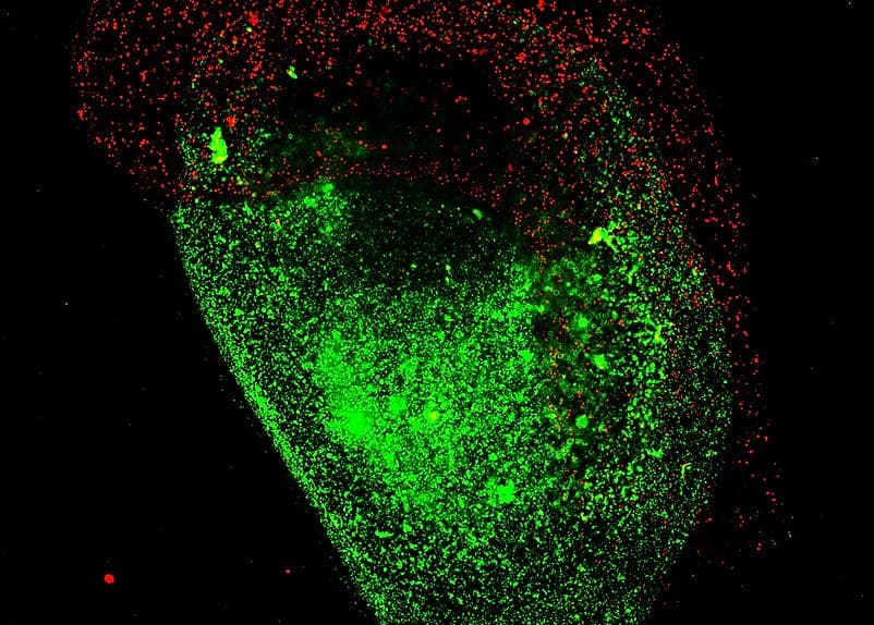 Prellis Biologics Pursues Bioprinted Lymph Nodes for Production of COVID-19 Antibodies